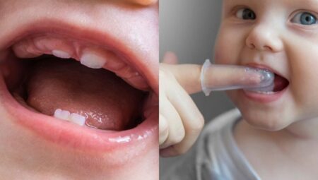 Diş çıkarma: Bebeğinizin ilk dişleri