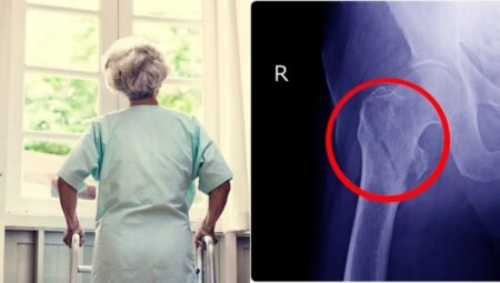 Kadınlar kalça kırığı riskini nasıl azaltabilir?