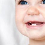 Bebeklerde Diş Çıkarma Dönemi ve Bakımı
